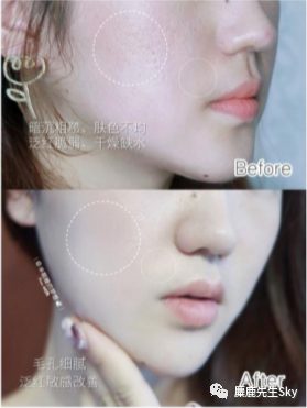 你的笔记“限流”真的不怪小红书! 553 你的笔记“限流”真的不怪小红书!